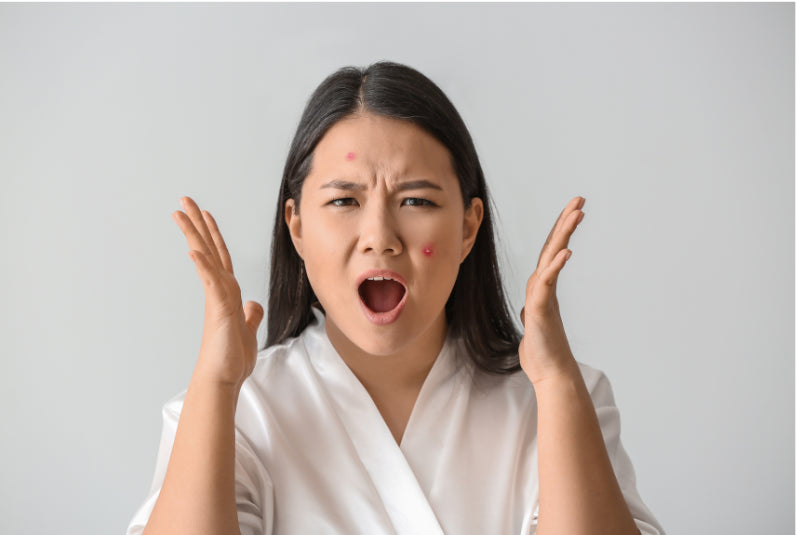 A woman with red acne blemishes on her forehead and cheek, wearing a white collared shirt, gesturing with her hands in a frustrated or explanatory expression against a light gray background.
